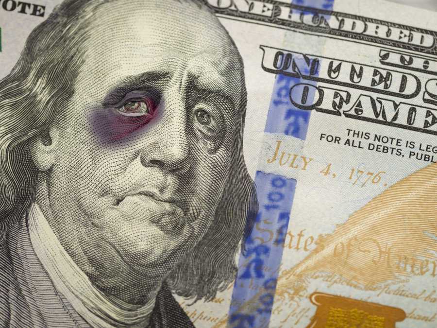 Bruised, Battered and Black Eyed Ben Franklin on the United States One Hundred Dollar Bill._id_7a119ea6-2783-4de0-a8cc-ff2469b7a9a7_size900.jpg